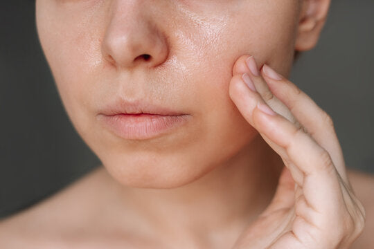 Oily Skin