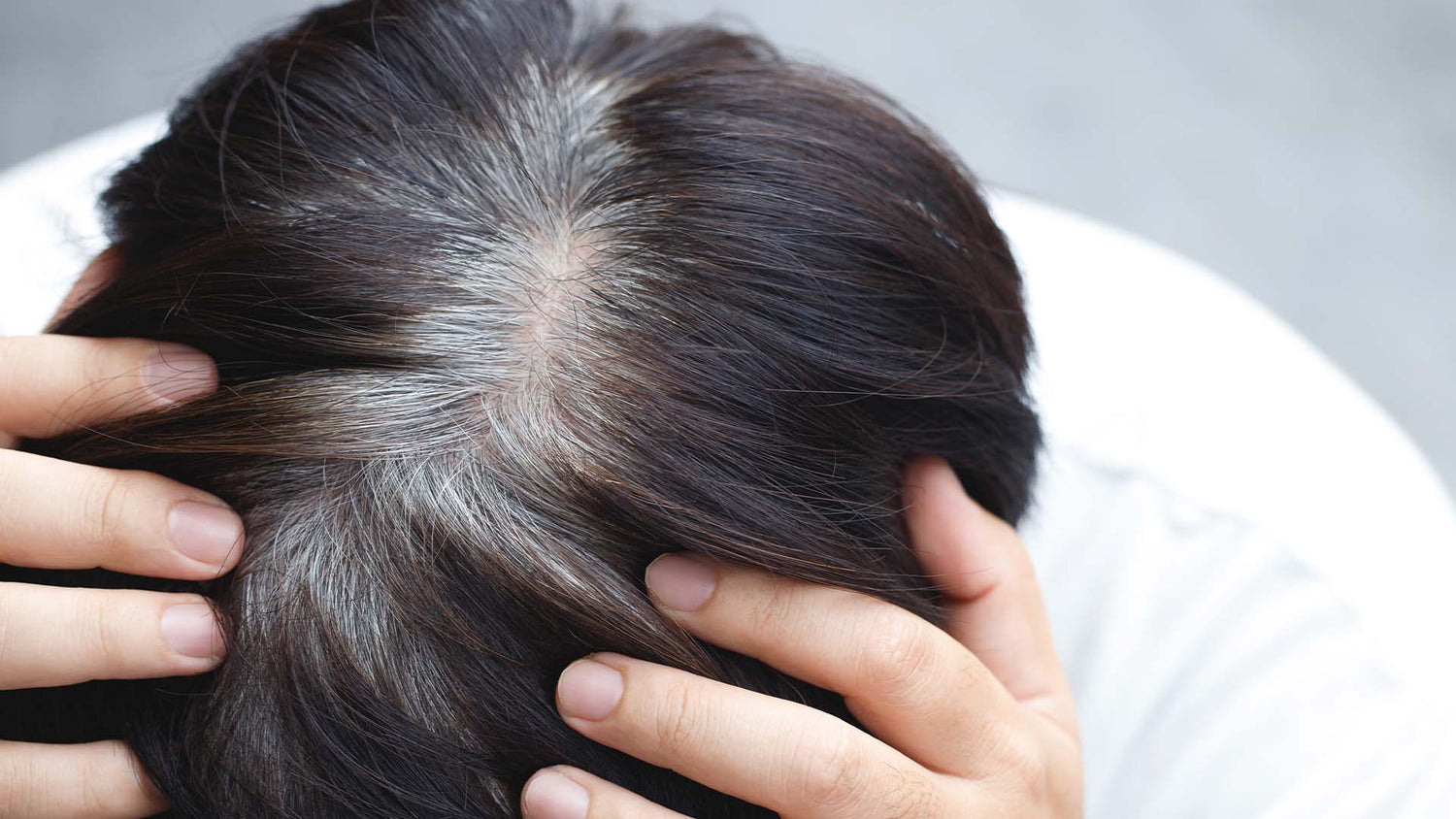 Premature Greying