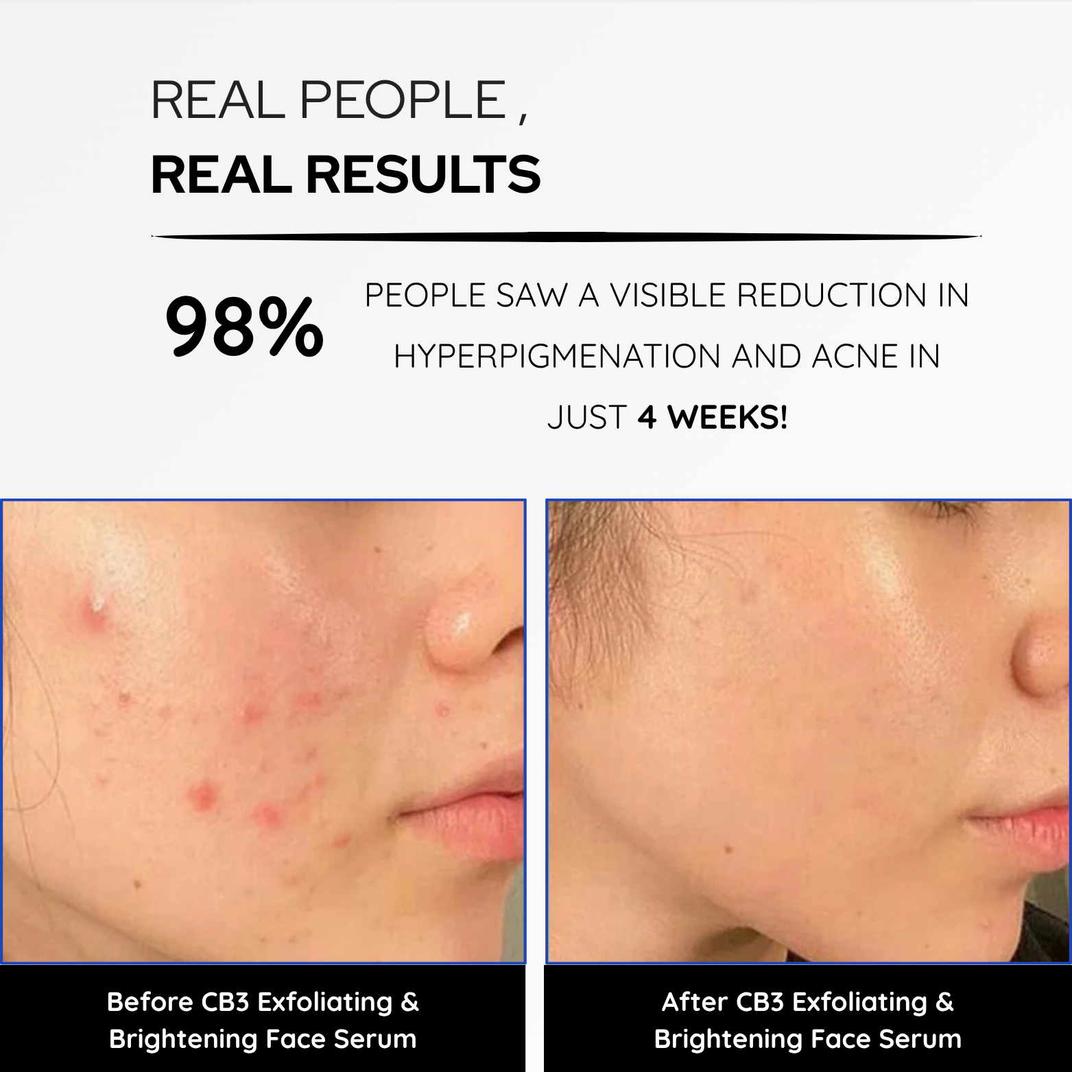 CB3 Brightening Serum