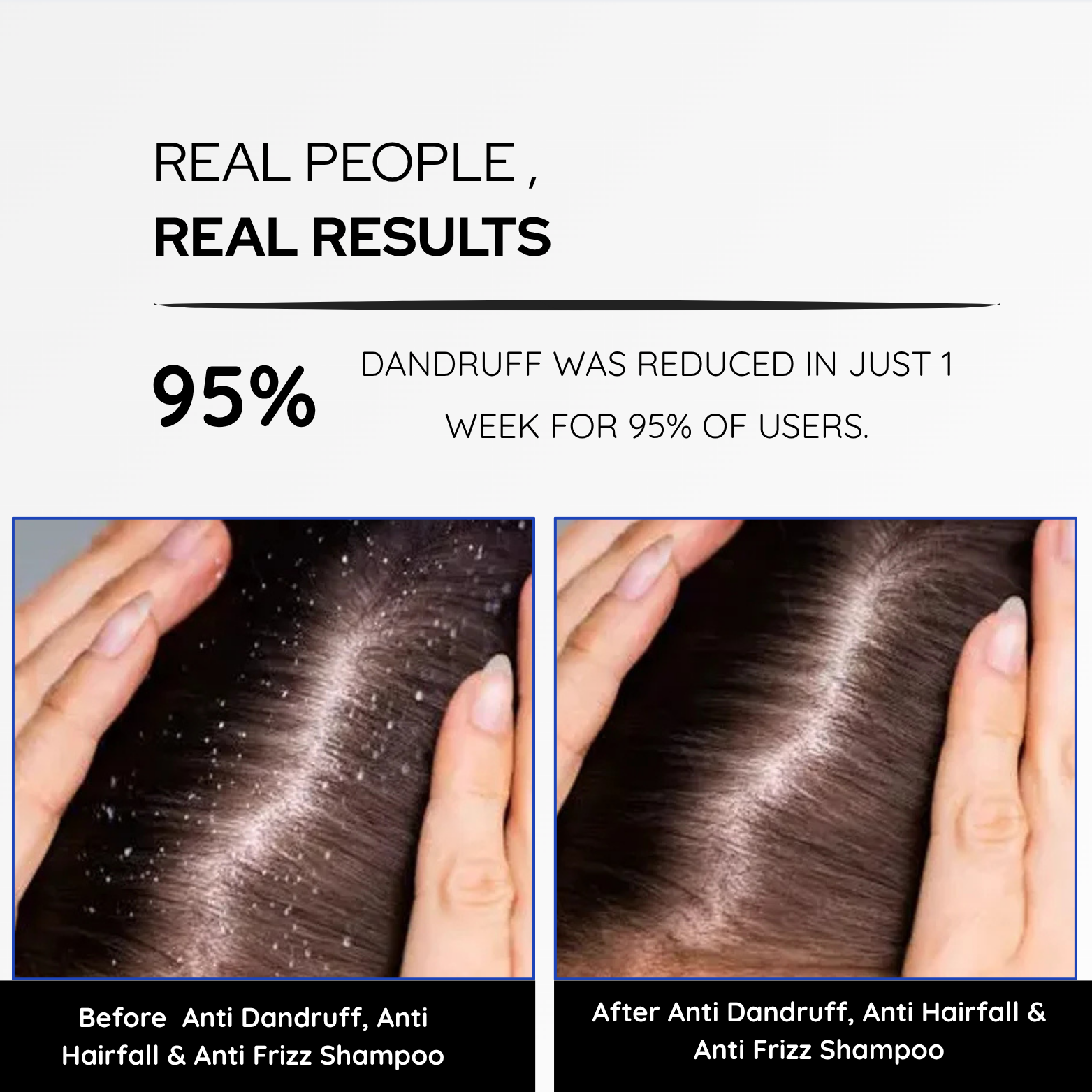 Hair fall & Dandruff Control Shampoo