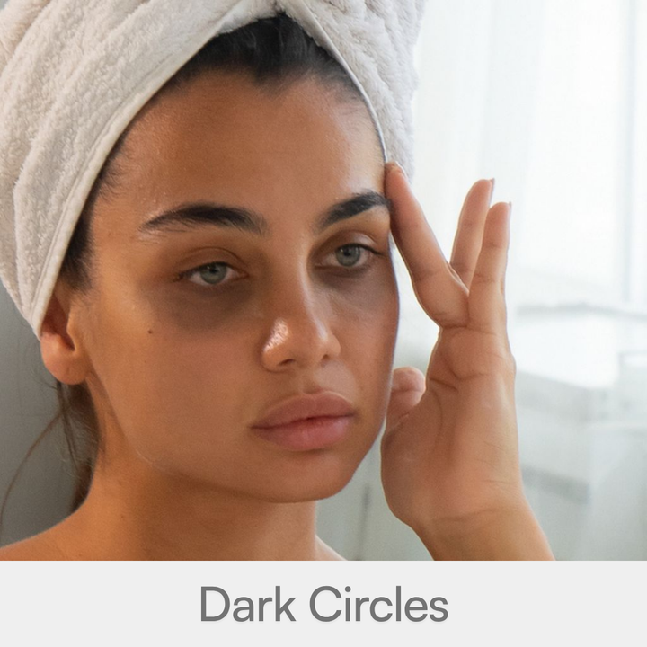 Dark Circles