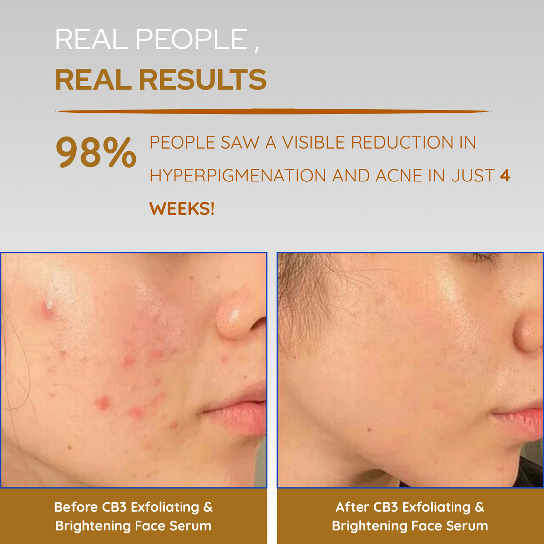 CB3 Exfoliating and Brightening Serum (5ml)